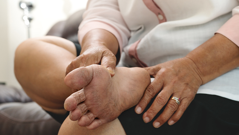 Diabetic taking care of her feet