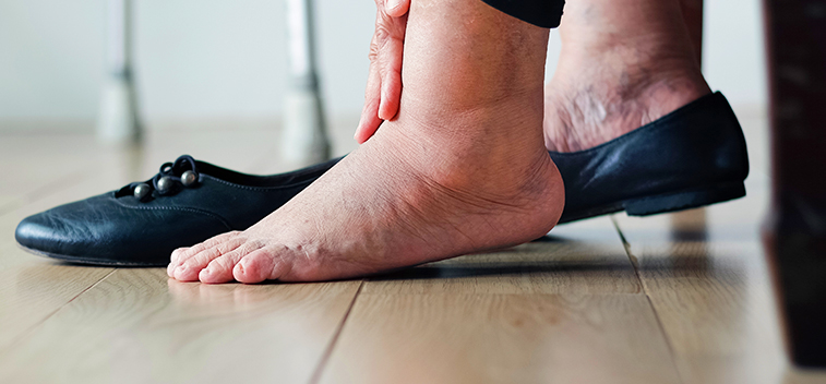 Patient experiencing Diabetic Neuropathy and in need of the neuropathy treatment protocol at Peninsula RSI Chiropractic Wellness Center in Redwood City