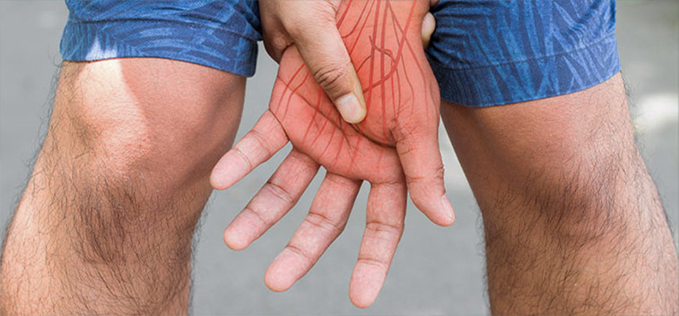 Patient experiencing neuralgia and in need of the neuropathy treatment protocol at Peninsula RSI Chiropractic Wellness Center in Redwood City