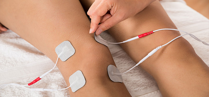 Patient receiving Electrical Stimulation Therapy as part of the neuropathy treatment protocol at Peninsula RSI Chiropractic Wellness Center in Redwood City